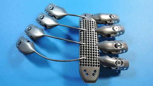 Rapid Prototyping & 3D Printing for Medical Device